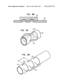 DEVICES AND METHODS FOR CONTROL OF BLOOD PRESSURE diagram and image