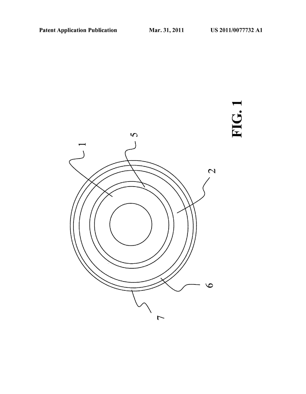 IMPLANT AND METHOD FOR MANUFACTURING SAME - diagram, schematic, and image 02