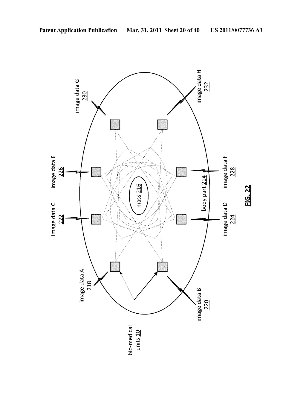 BREAST IMPLANT SYSTEM INCLUDING BIO-MEDICAL UNITS - diagram, schematic, and image 21