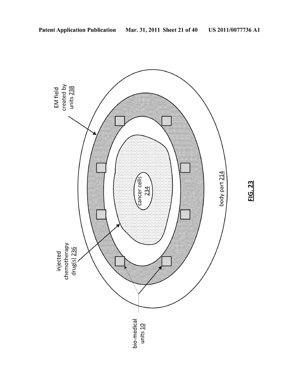 BREAST IMPLANT SYSTEM INCLUDING BIO-MEDICAL UNITS - diagram, schematic, and image 22