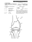 Method for cleaning or limiting adhesive. diagram and image