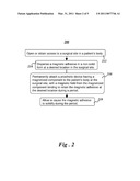 Method for cleaning or limiting adhesive. diagram and image