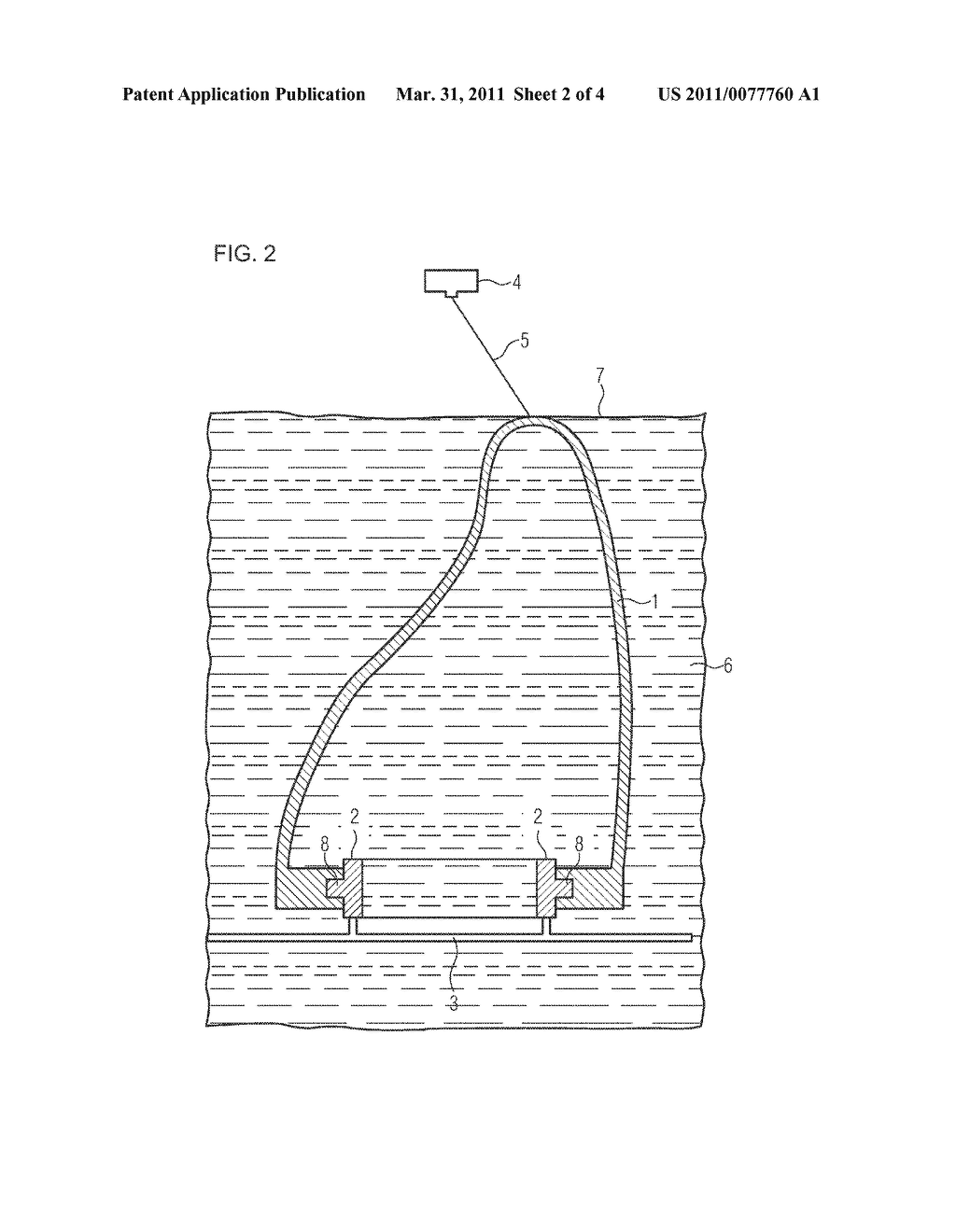 METHOD OF PRODUCING A HOUSING SHELL OR EAR MOLD TO BE WORN IN THE EAR - diagram, schematic, and image 03