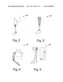 Systems and Methods for Personalizing Prosthetic and Orthotic Devices diagram and image