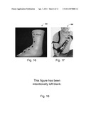 Systems and Methods for Personalizing Prosthetic and Orthotic Devices diagram and image