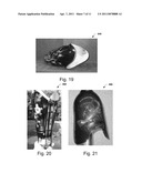 Systems and Methods for Personalizing Prosthetic and Orthotic Devices diagram and image