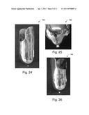 Systems and Methods for Personalizing Prosthetic and Orthotic Devices diagram and image