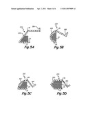 COMPLIANT COIL FORM diagram and image