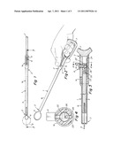 CERVICAL OCCLUDER diagram and image