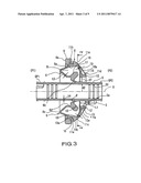 GROMMET diagram and image