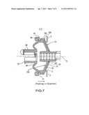 GROMMET diagram and image