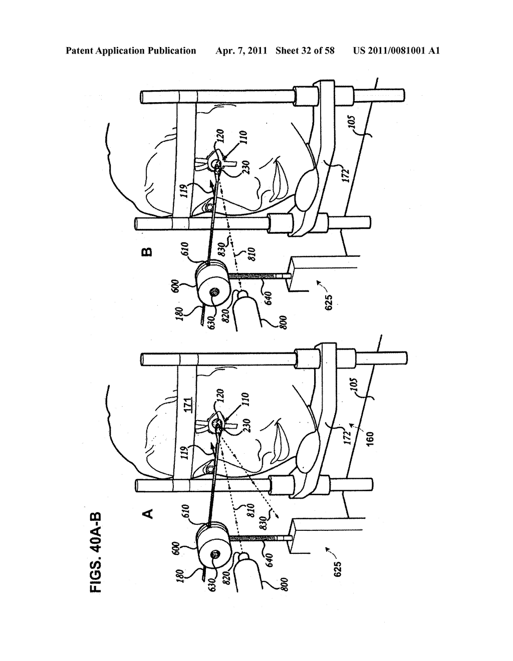 METHODS AND DEVICES FOR ORTHOVOLTAGE OCULAR RADIOTHERAPY AND TREATMENT PLANNING - diagram, schematic, and image 33