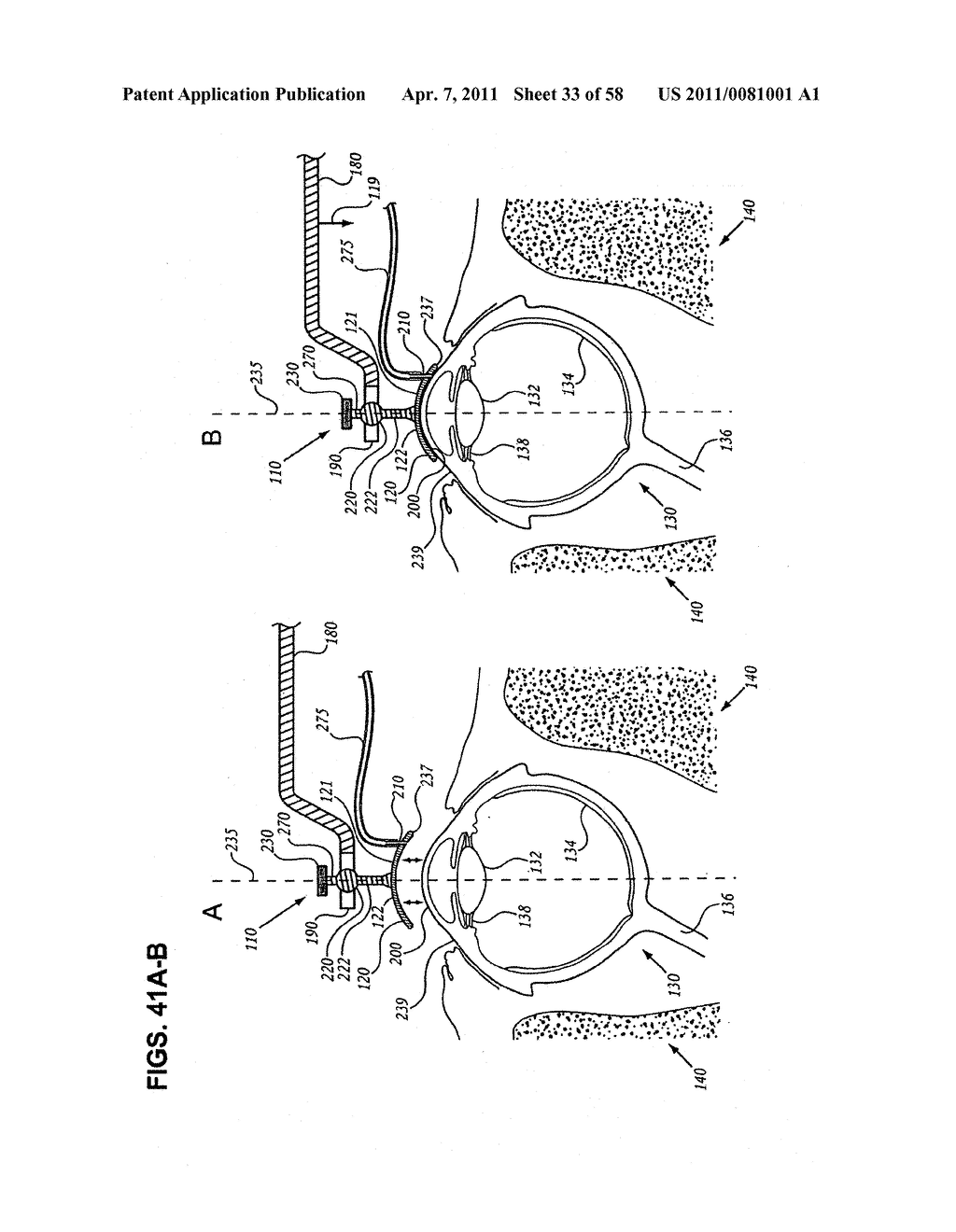 METHODS AND DEVICES FOR ORTHOVOLTAGE OCULAR RADIOTHERAPY AND TREATMENT PLANNING - diagram, schematic, and image 34