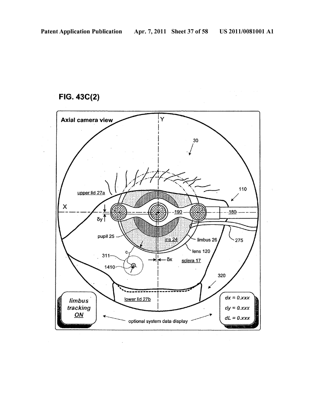 METHODS AND DEVICES FOR ORTHOVOLTAGE OCULAR RADIOTHERAPY AND TREATMENT PLANNING - diagram, schematic, and image 38