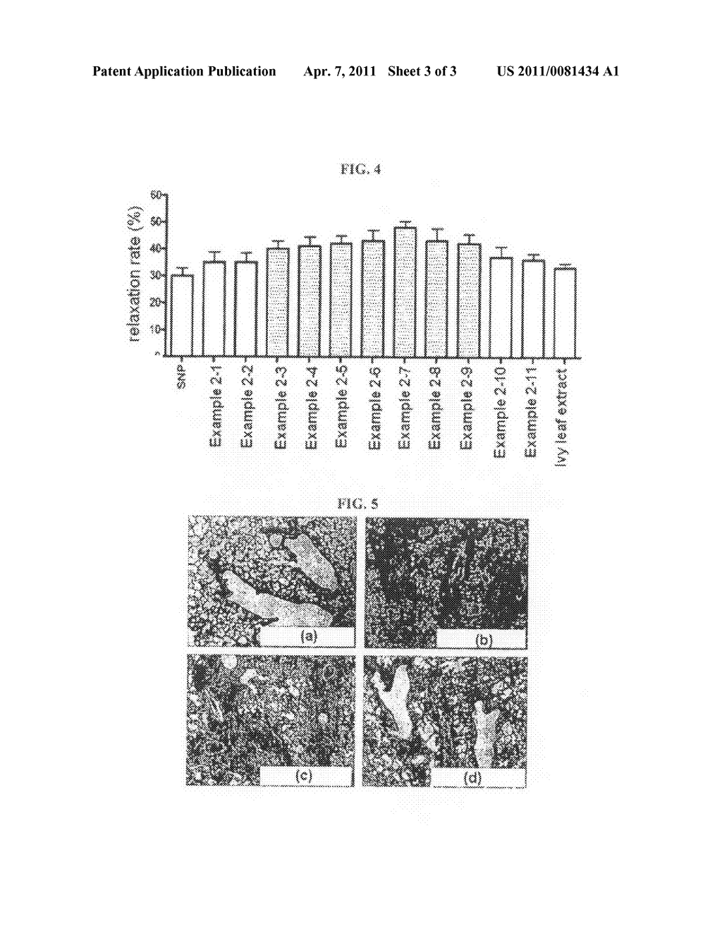 Extract of Coptidis Rhizoma and novel use thereof in treating respiratory disease - diagram, schematic, and image 04