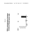 FREE NGAL AS A BIOMARKER FOR CANCER diagram and image