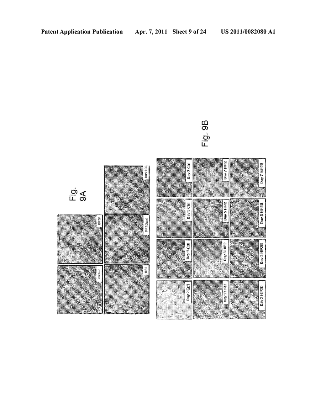 COMPOSITIONS AND METHODS OF USING THE HUMAN PROISLET PEPTIDE RECEPTOR - diagram, schematic, and image 10