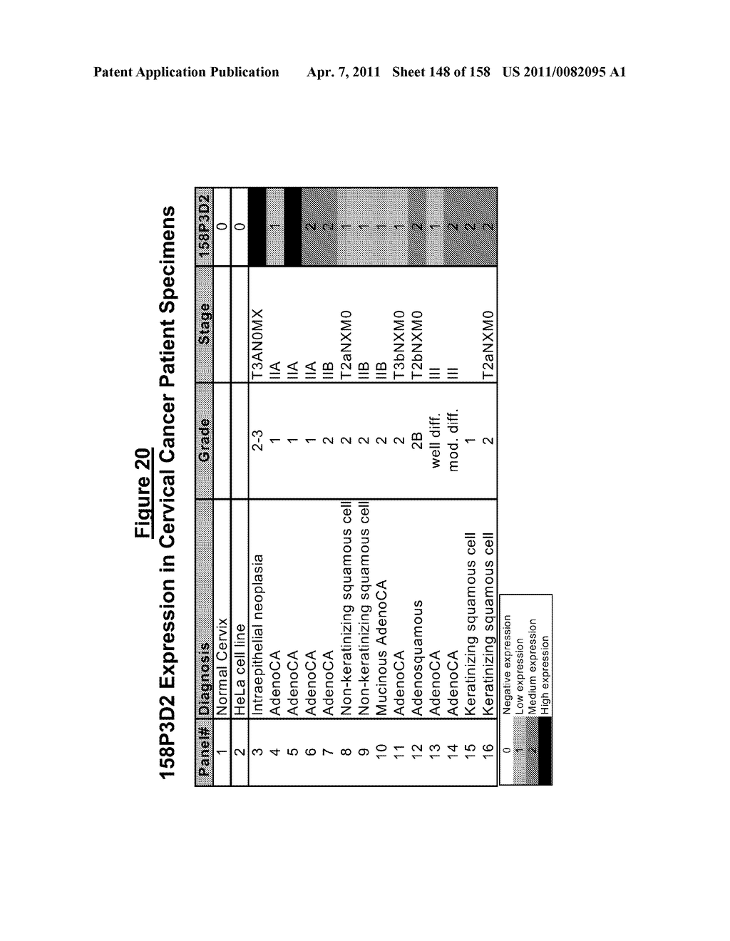 NUCLEIC ACIDS AND CORRESPONDING PROTEINS ENTITLED 158P3D2 USEFUL IN TREATMENT AND DETECTION OF CANCER - diagram, schematic, and image 149