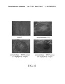 Anoectochilus SPP. polysaccharide extracts for stimulating growth of advantageous bacteria, stimuating release of granulocyte colony-Stimulating factor, modulating T helper cell type I, and/or modulating T helper cell type II and uses of the same diagram and image