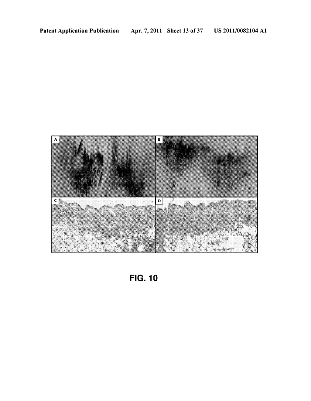 ALKYLATED SEMI SYNTHETIC GLYCOSAMINOGLYCOSAN ETHERS, AND METHODS FOR MAKING AND USING THEREOF - diagram, schematic, and image 14