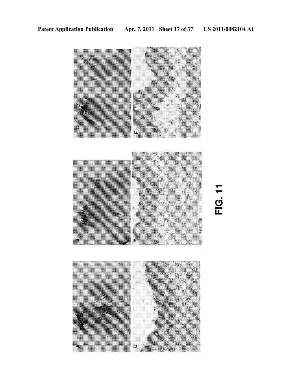 ALKYLATED SEMI SYNTHETIC GLYCOSAMINOGLYCOSAN ETHERS, AND METHODS FOR MAKING AND USING THEREOF - diagram, schematic, and image 18