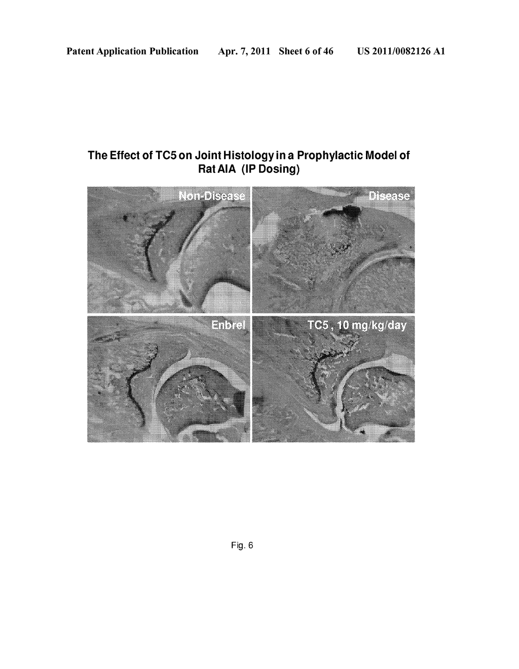 METHOD FOR TREATING INFLAMMATORY CONDITIONS - diagram, schematic, and image 07