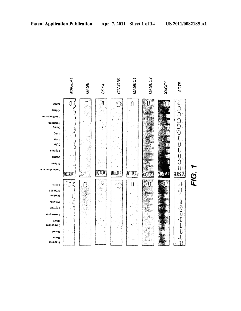 CANCER-TESTIS GENE SILENCING AGENTS AND USES THEREOF - diagram, schematic, and image 02