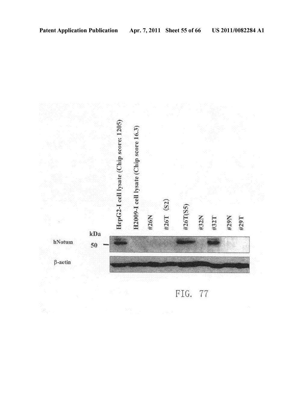 Gene overexpressed in cancer - diagram, schematic, and image 56