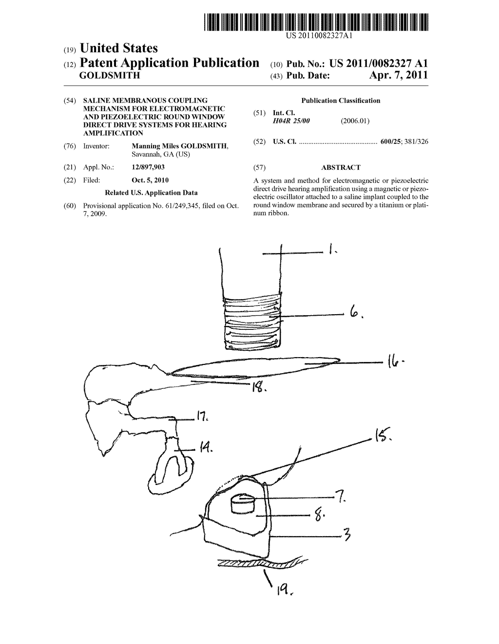 SALINE MEMBRANOUS COUPLING MECHANISM FOR ELECTROMAGNETIC AND PIEZOELECTRIC ROUND WINDOW DIRECT DRIVE SYSTEMS FOR HEARING AMPLIFICATION - diagram, schematic, and image 01