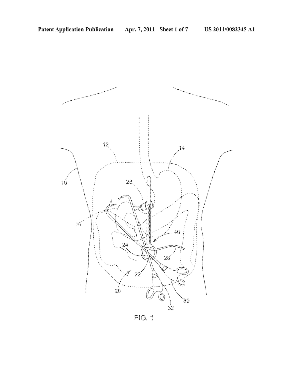 APPARATUS FOR SINGLE PORT ACCESS - diagram, schematic, and image 02