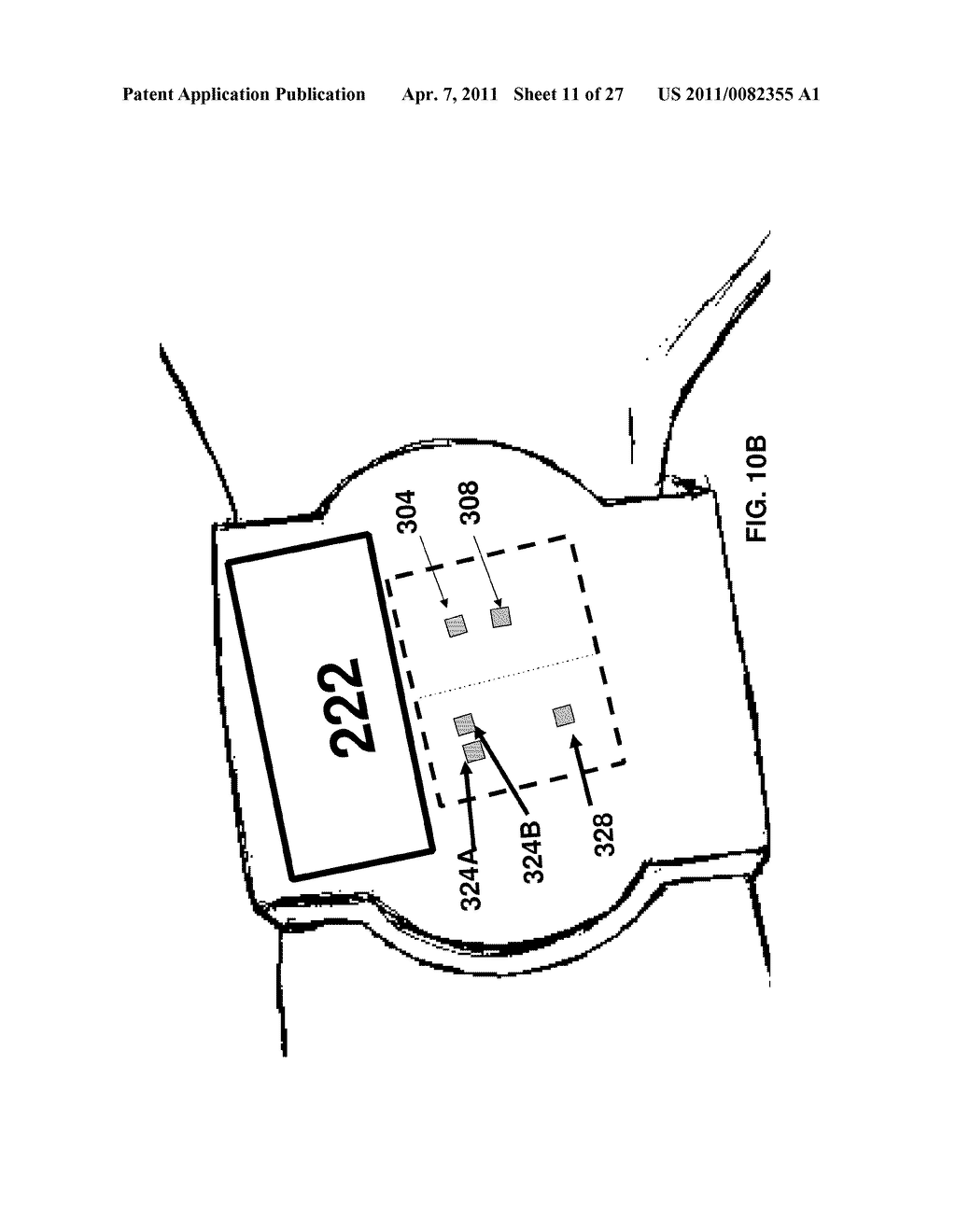 PHOTOPLETHYSMOGRAPHY DEVICE AND METHOD - diagram, schematic, and image 12