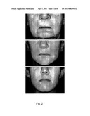 METHODS FOR MEASURING CHANGE IN LIP SIZE AFTER AUGMENTATION diagram and image