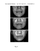 METHODS FOR MEASURING CHANGE IN LIP SIZE AFTER AUGMENTATION diagram and image