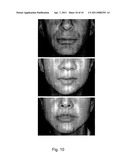 METHODS FOR MEASURING CHANGE IN LIP SIZE AFTER AUGMENTATION diagram and image