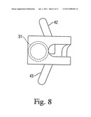 Device for treating hallux varus diagram and image