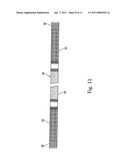 Device for treating hallux varus diagram and image