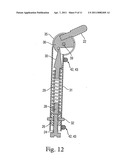 Device for treating hallux varus diagram and image