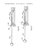 METHOD AND APPARATUS FOR BONE GRAFT INSERTION diagram and image