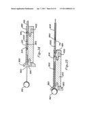 METHOD AND APPARATUS FOR BONE GRAFT INSERTION diagram and image