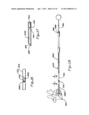 METHOD AND APPARATUS FOR BONE GRAFT INSERTION diagram and image