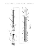 Elongate Medical Device with Continuous Reinforcement Member diagram and image