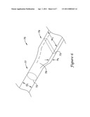 Elongate Medical Device with Continuous Reinforcement Member diagram and image