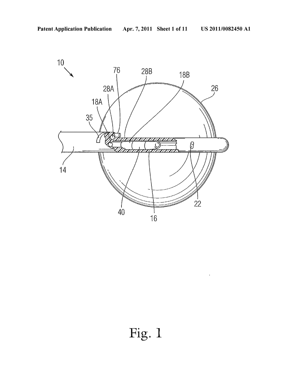 CARDIAC ABLATION SYSTEM WITH INFLATABLE MEMBER HAVING MULTIPLE INFLATION SETTINGS - diagram, schematic, and image 02