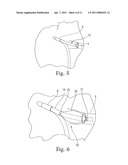 CARDIAC ABLATION SYSTEM WITH AUTOMATIC SAFETY SHUT-OFF FEATURE diagram and image