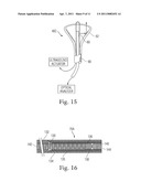 CARDIAC ABLATION SYSTEM WITH AUTOMATIC SAFETY SHUT-OFF FEATURE diagram and image