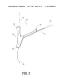 ENDOVASCULAR CONDUIT DEVICE WITH LOW PROFILE OCCLUSION MEMBERS diagram and image