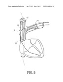 ENDOVASCULAR CONDUIT DEVICE WITH LOW PROFILE OCCLUSION MEMBERS diagram and image