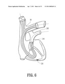 ENDOVASCULAR CONDUIT DEVICE WITH LOW PROFILE OCCLUSION MEMBERS diagram and image