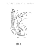 ENDOVASCULAR CONDUIT DEVICE WITH LOW PROFILE OCCLUSION MEMBERS diagram and image