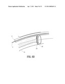 ENDOVASCULAR CONDUIT DEVICE WITH LOW PROFILE OCCLUSION MEMBERS diagram and image